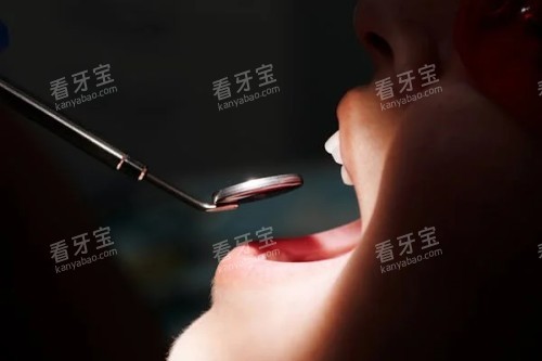 牙齿检查展示图 牙齿检查展示图