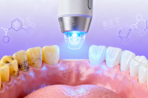 牙齿美白修复卡通展示图 牙齿美白修复卡通展示图