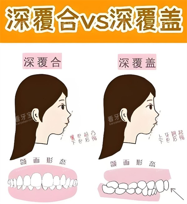 ϵ°ͺô죿 ܷͣⷽ