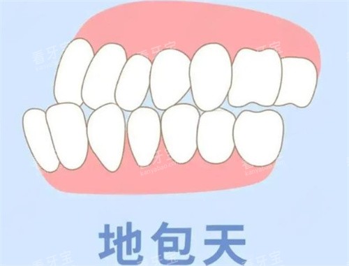 地包天动画展示图 地包天动画展示图