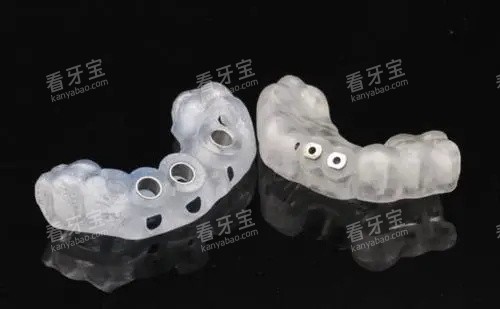 种植牙导板.webp 种植牙导板.webp