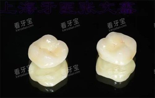 爱尔创全瓷牙超全攻略!品牌实力+4大系列详解,看完秒懂怎么选!