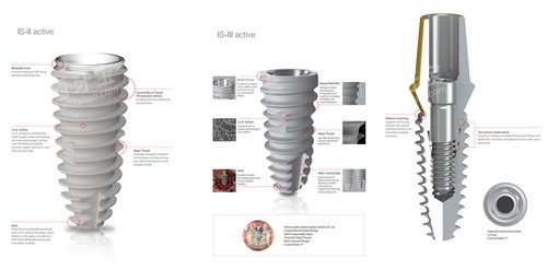 韩国纽百特种植牙植体设计 韩国纽百特种植牙植体设计