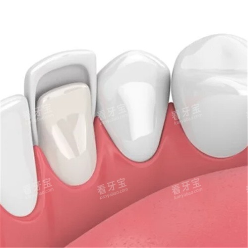 ���������ڲ�