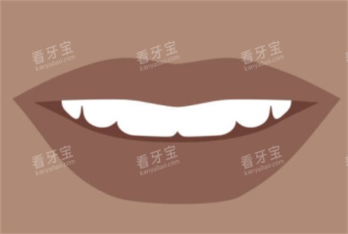 牙齿洁白图 牙齿洁白图