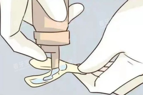 儿牙涂氟展示图 儿牙涂氟展示图