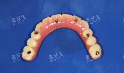 半口牙齿 半口牙齿