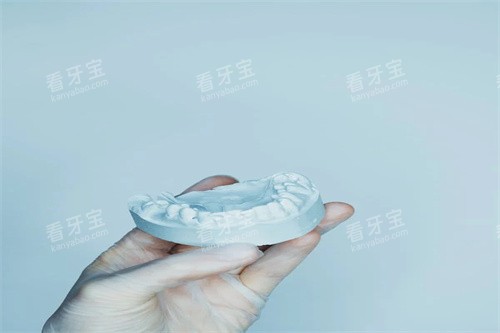 牙齿矫正模型展示 牙齿矫正模型展示