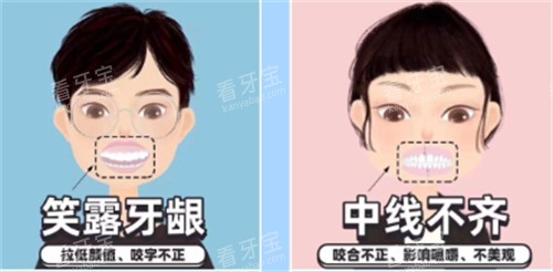 需要矫正的牙齿图解 需要矫正的牙齿图解