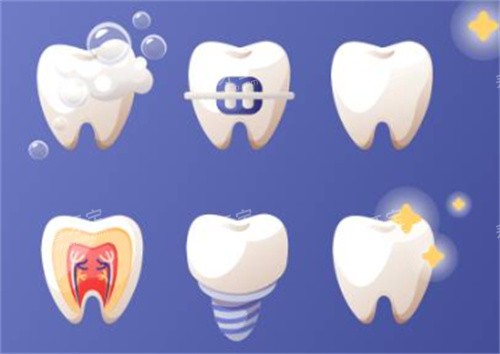牙齿的各个项目 牙齿的各个项目