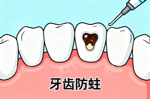 牙齿防蛀卡通图 牙齿防蛀卡通图