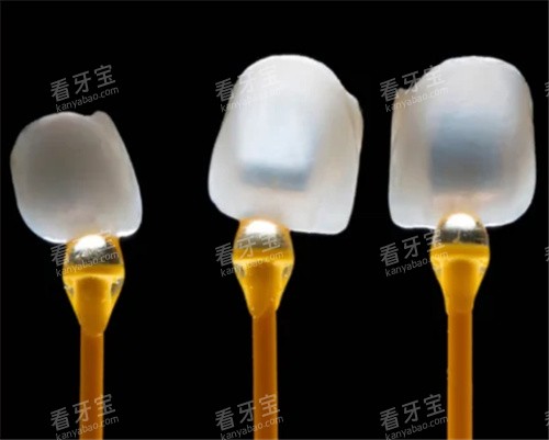 牙齿贴面透光性好 牙齿贴面透光性好