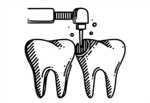 电钻钻牙齿 电钻钻牙齿