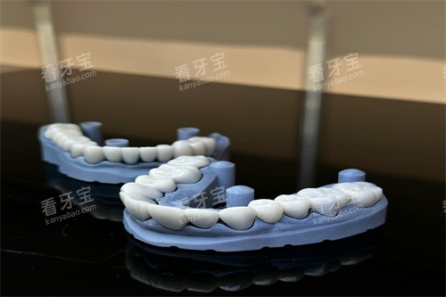 假牙正在制作 假牙正在制作