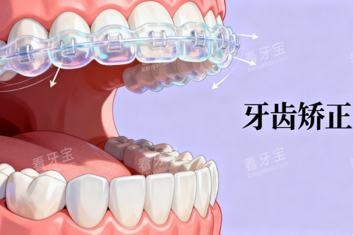 隐形牙齿矫正器卡通展示图 隐形牙齿矫正器卡通展示图