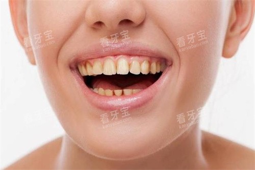 发黄的牙齿 发黄的牙齿