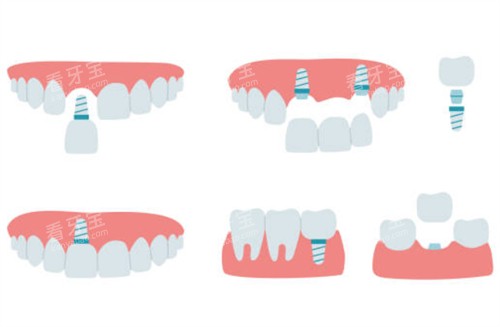 南京英博口腔门诊部地址在哪里?位于秦淮区吉庆路31-1号,正规值得信赖!