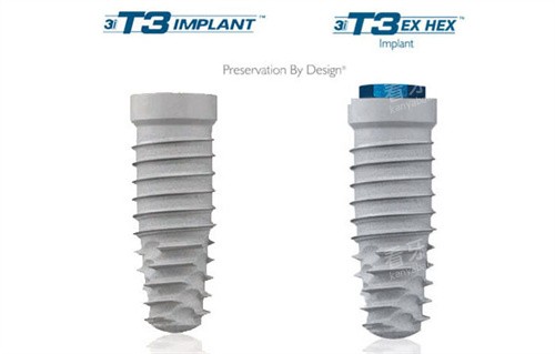 ����3I��ֲ��չʾ