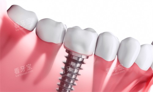 ��ֲ����ֲ�������