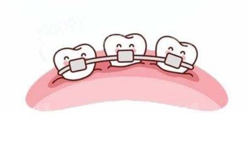 畸形牙齿矫正卡通图 畸形牙齿矫正卡通图