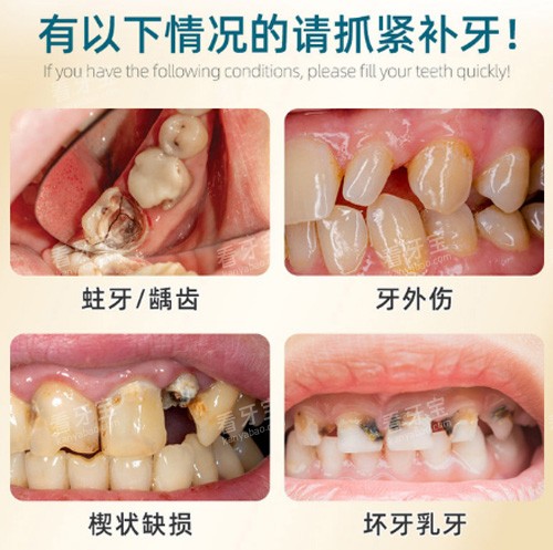 牙科问题线上问询免费_24小时牙科问询在线问答_牙齿在线问询免费网上在线解答口腔问题
