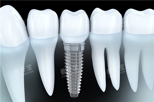 ������ֲ��ͼʾ