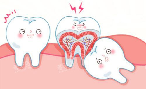 牙齿阻生卡通图 牙齿阻生卡通图