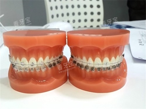 北京牙元素口腔牙齿矫正怎么样?医生团队、技术优势等您看下