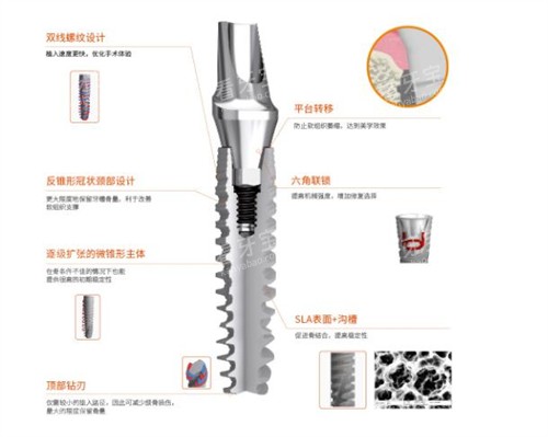 国产百齿泰种植牙优势 国产百齿泰种植牙优势