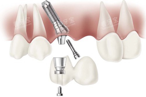 ��ֲ��һ�϶���Чͼ