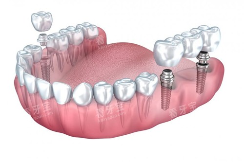 ��ֲ���ż�ʾ��ͼ