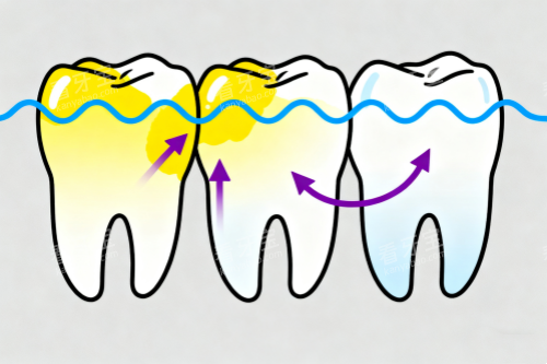 �������ױ仯ͼ