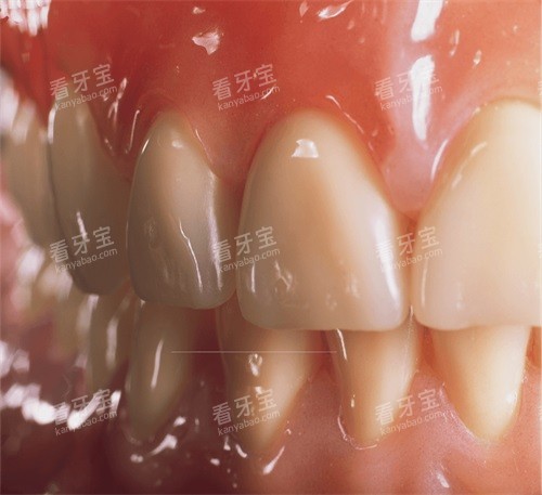 �������������ϸ��չʾͼ