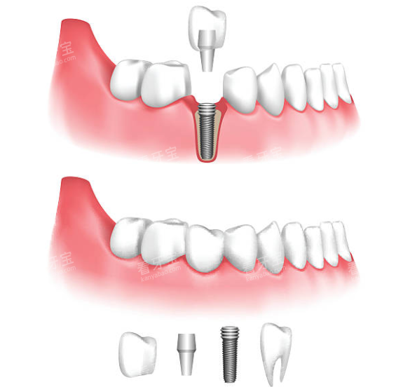 ��ֲ�����ʾ��ͼ