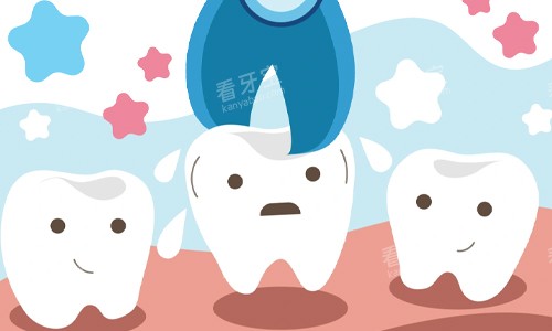 拔牙展示图 拔牙展示图