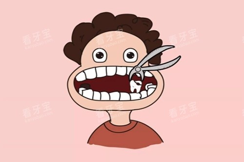 拔牙卡通示意图 拔牙卡通示意图