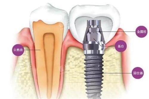 ��ֲ������ɽ���