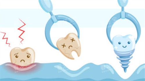 ��������ͼ