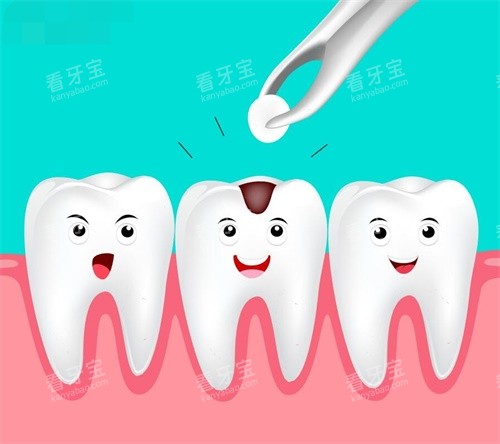 补牙示意图 补牙示意图