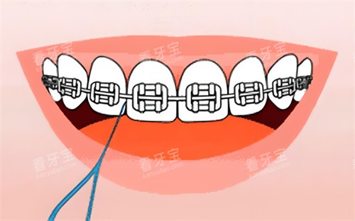 �������ݽ�����ͨͼƬ