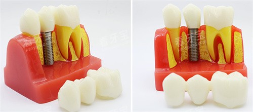 ��ֲ��ģ�� ͼƬ