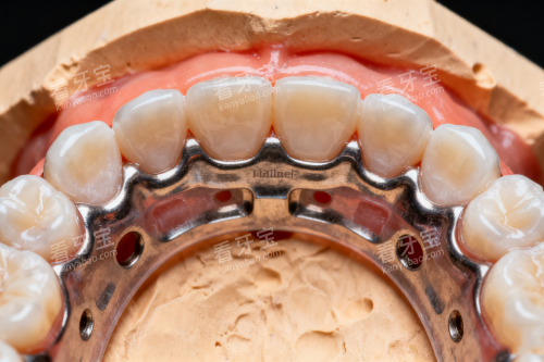 牙齿矫正之后的样子展示 牙齿矫正之后的样子展示