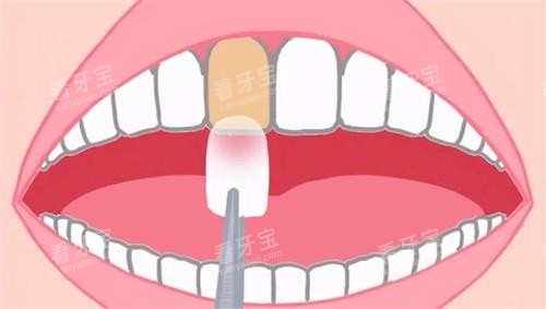 �������涯��ʾ��ͼ