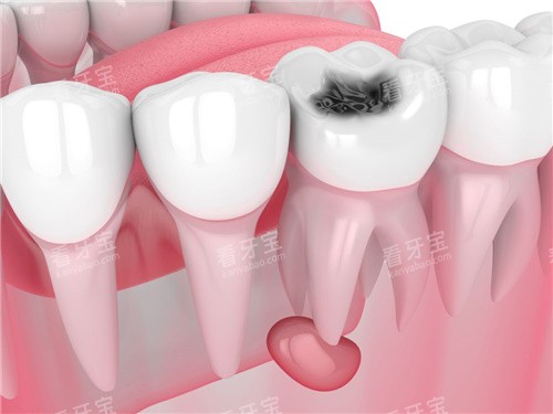 ���ݸ�������