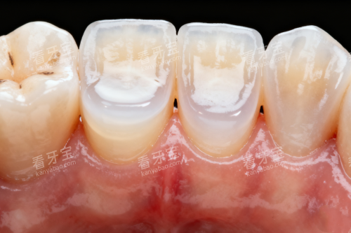 ���ݷ���ͼƬչʾ