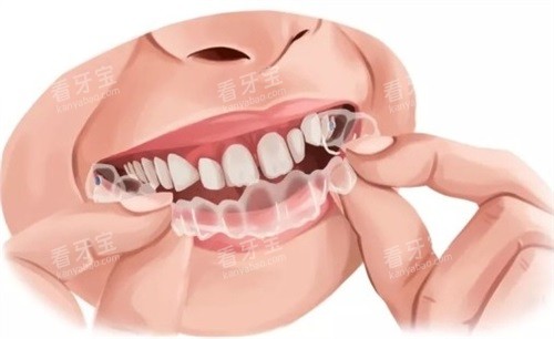 ���ν��������������ͼ