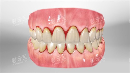 ���ݸ���������Ѫ