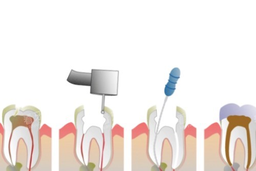 �������ƿ�ͨ����ͼ