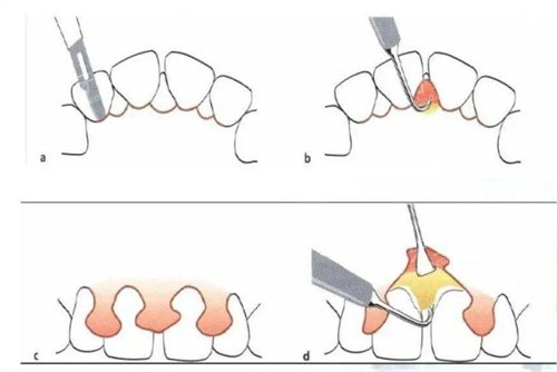 �����׷���������ô��