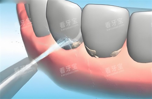 ϴ������չʾͼƬ